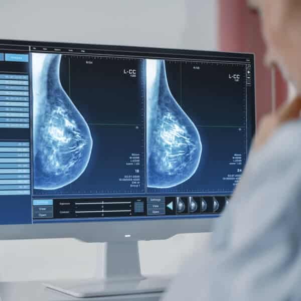Mammography-home